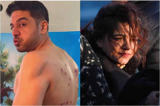 ‘Khatron Ke Khiladi 15’: Gaurav Khanna and Rubina Dilaik’s Injuries Raise The Question — Is Reality TV Pushing Its Limits? (EXCLUSIVE)